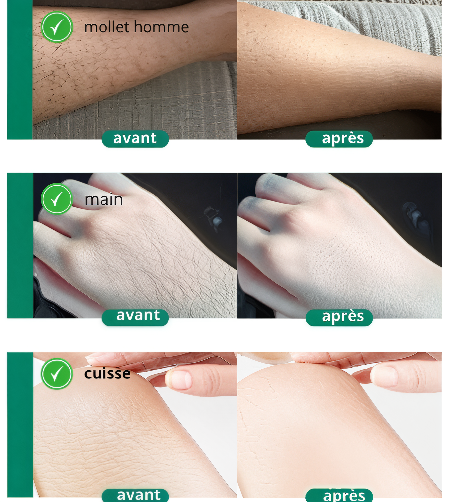 Gomme Épilatoire Cristal Réutilisable – Pour une Peau Lisse et sans douleur